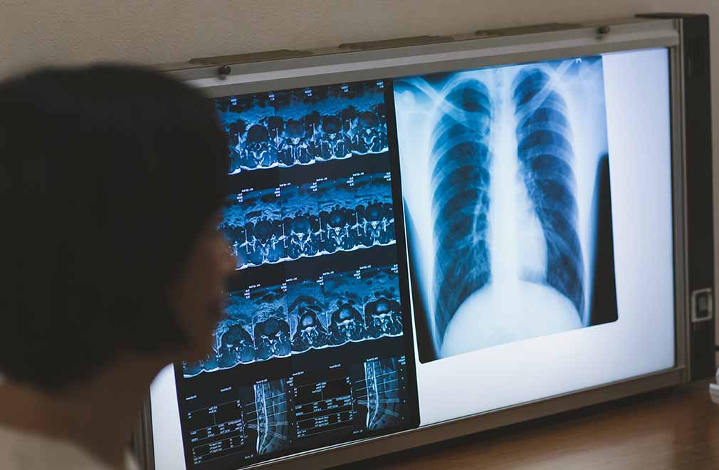 レンタル・リース